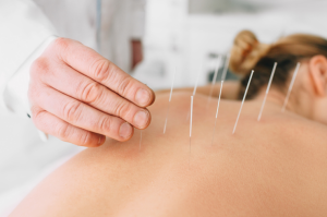 Acupuncture in a Serene Setting: Discover A Holistic Approach to Wellness at the Best Spa in Brooklyn